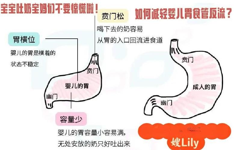 新生儿食道狭窄会出现哪些典型症状?家长又该如何早期识别与应对?-第1张图片-郑州医学网 新生儿食道狭窄会出现哪些典型症状?家长又该如何早期识别与应对?-第1张图片-郑州医学网