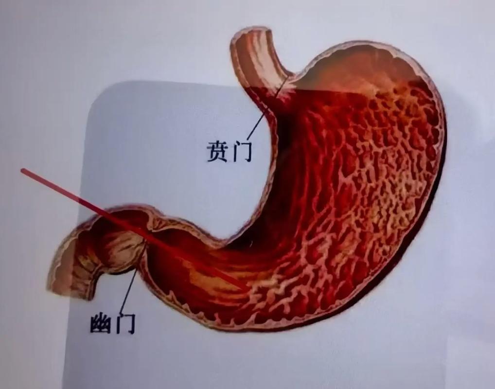 新生儿食道狭窄会出现哪些典型症状?家长又该如何早期识别与应对?-第2张图片-郑州医学网 新生儿食道狭窄会出现哪些典型症状?家长又该如何早期识别与应对?-第2张图片-郑州医学网