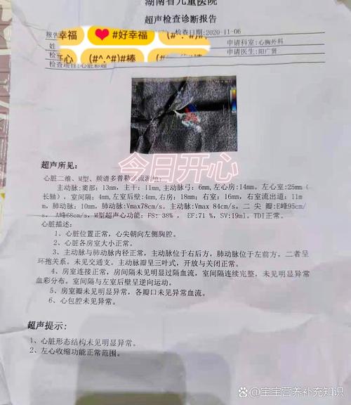 满月新生儿心脏有杂音是生理性还是病理性?需要立即干预吗?-第2张图片-郑州医学网 满月新生儿心脏有杂音是生理性还是病理性?需要立即干预吗?-第2张图片-郑州医学网