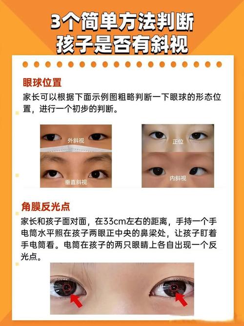 儿童单眼弱视怎么矫正-第2张图片-郑州医学网