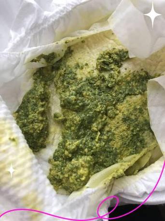 新生儿大便绿色怎么办-第2张图片-郑州医学网