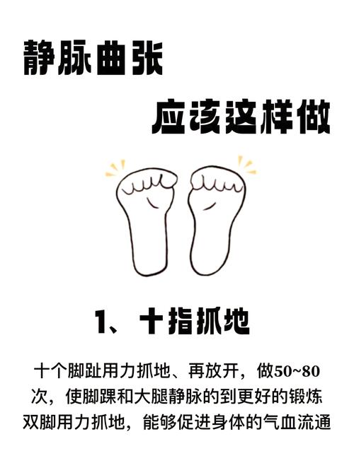 怎么预防孕期静脉曲张-第1张图片-郑州医学网