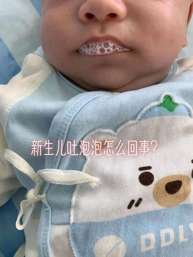 新生儿吐唾沫是正常的-第1张图片-郑州医学网