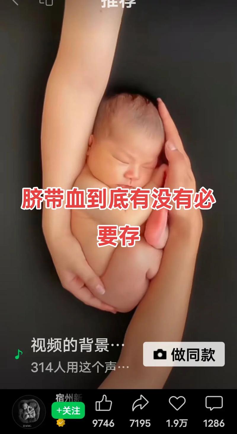 新生儿肚脐带根部有血丝是感染还是脱落异常?需如何护理处理?-第1张图片-郑州医学网 新生儿肚脐带根部有血丝是感染还是脱落异常?需如何护理处理?-第1张图片-郑州医学网