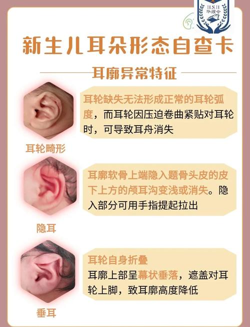 新生儿耳朵发黑是正常现象吗？需要担心健康问题吗？-第1张图片-郑州医学网