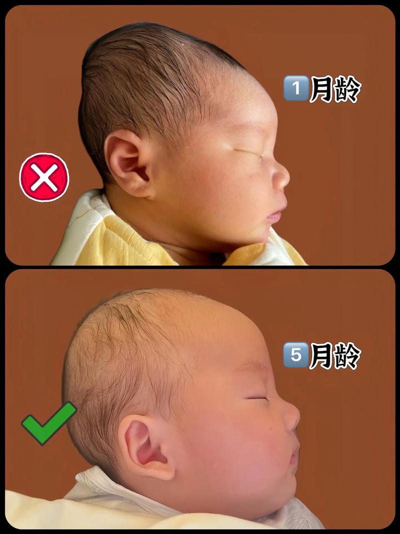 新生儿头侧着睡觉会导致歪头或影响发育吗？正确睡姿该注意什么？-第2张图片-郑州医学网