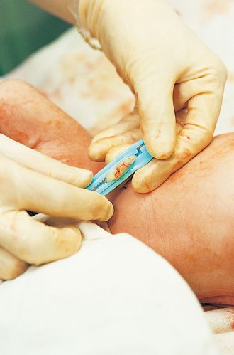 新生儿出生查什么东西-第3张图片-郑州医学网 新生儿出生查什么东西-第3张图片-郑州医学网