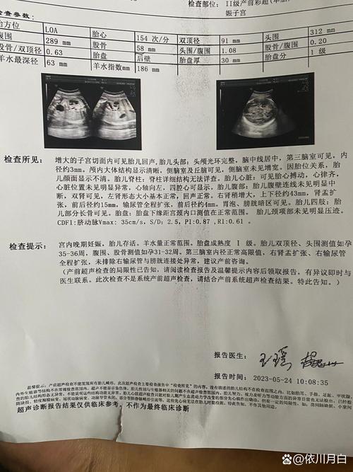 新生儿双肾实质回声增强是异常信号吗？需警惕哪些疾病风险？-第3张图片-郑州医学网