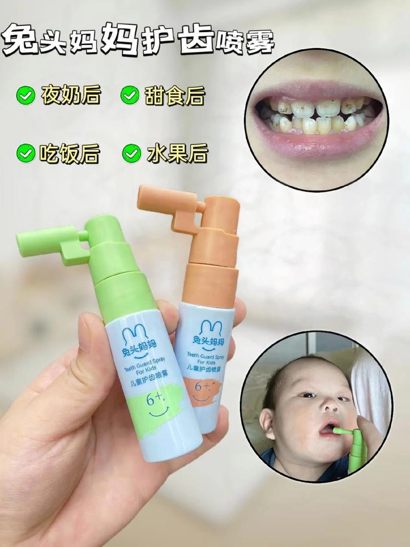 儿童牙齿发黄怎么去除-第2张图片-郑州医学网