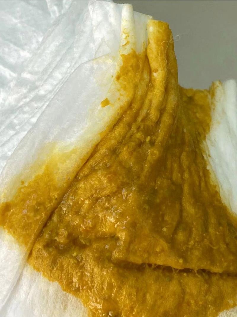 新生儿大便自己流出来-第2张图片-郑州医学网