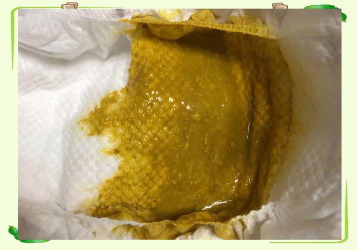 新生儿大便自己流出来-第1张图片-郑州医学网 新生儿大便自己流出来-第1张图片-郑州医学网