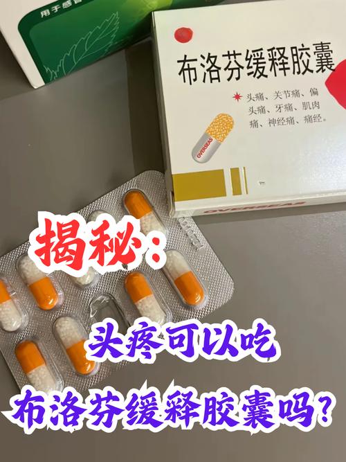 孕期头疼能吃止疼药吗-第1张图片-郑州医学网