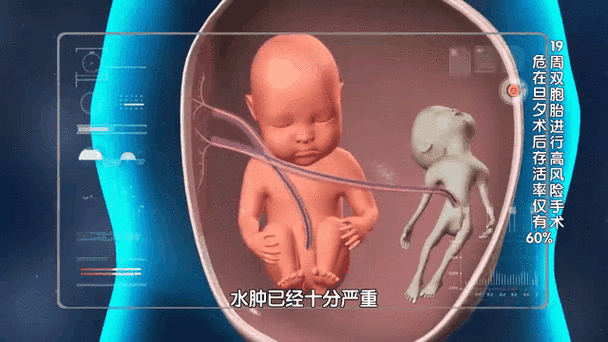 孕期十九周胎儿发育图-第2张图片-郑州医学网