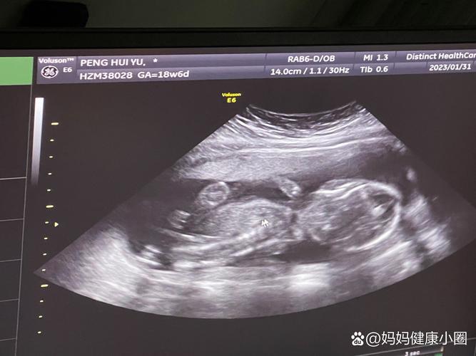 孕期十九周胎儿发育图-第3张图片-郑州医学网