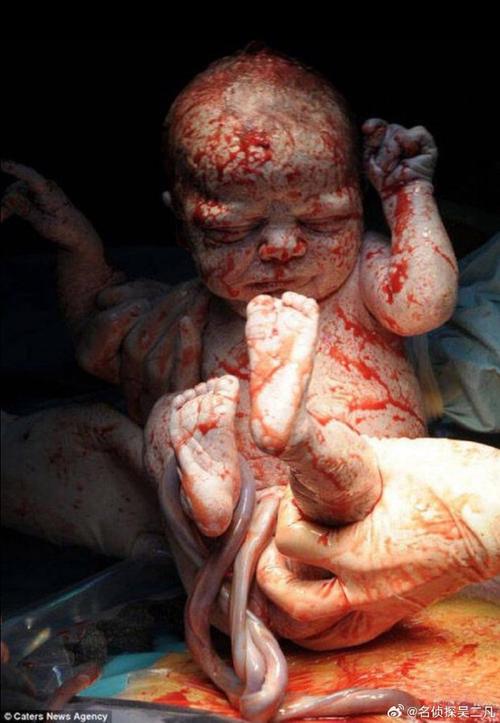 胎儿在子宫内的真实图片是如何形成的?对准妈妈有哪些科学启示?-第2张图片-郑州医学网 胎儿在子宫内的真实图片是如何形成的?对准妈妈有哪些科学启示?-第2张图片-郑州医学网