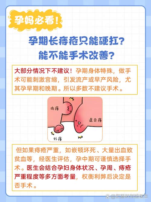 为什么孕期容易得痔疮-第1张图片-郑州医学网