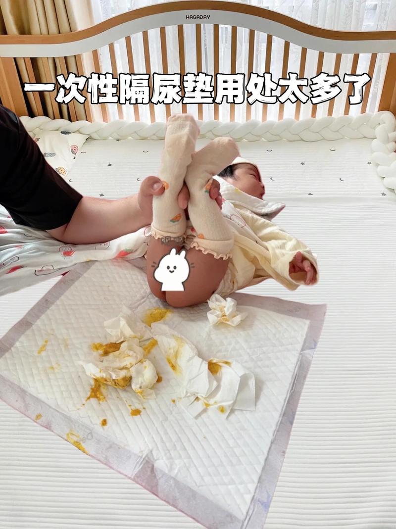 新生儿尿不湿拉屎就换-第2张图片-郑州医学网