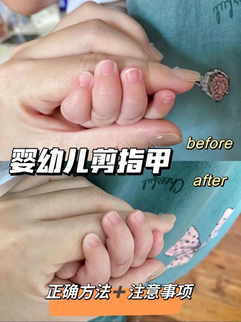 新生儿什么可以剪指甲-第1张图片-郑州医学网