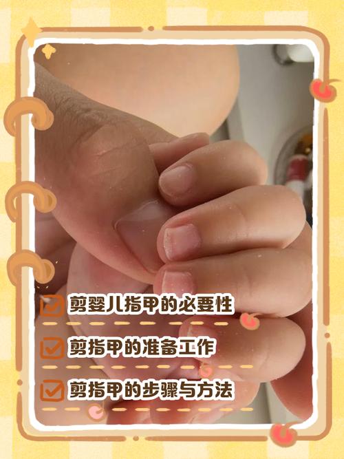 新生儿什么可以剪指甲-第3张图片-郑州医学网