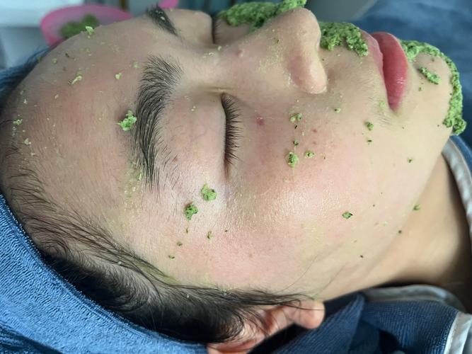 孕期用黄瓜敷脸安全吗？会对胎儿有影响吗？-第2张图片-郑州医学网