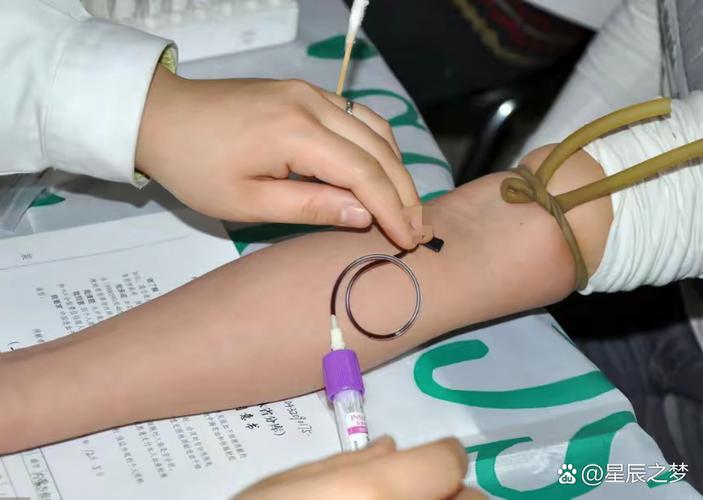 新生儿黄疸抽血怎么抽-第3张图片-郑州医学网