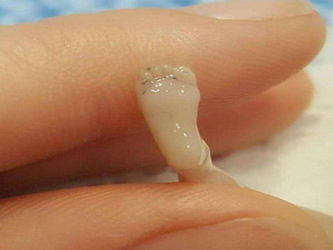 早孕期打掉孩子的身心煎熬，该如何承受与疗愈？-第1张图片-郑州医学网