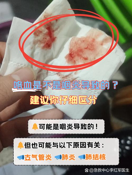 孕期喉咙出血是上火还是身体异常信号？需警惕哪些潜在风险？-第1张图片-郑州医学网