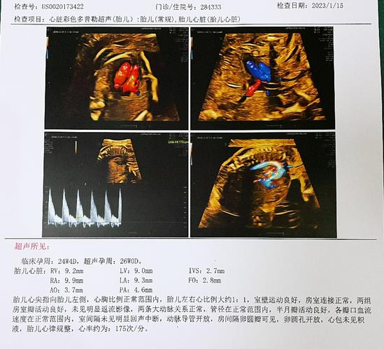孕期心脏彩超能查出哪些先天性心脏病？检查时机和注意事项有哪些？-第1张图片-郑州医学网