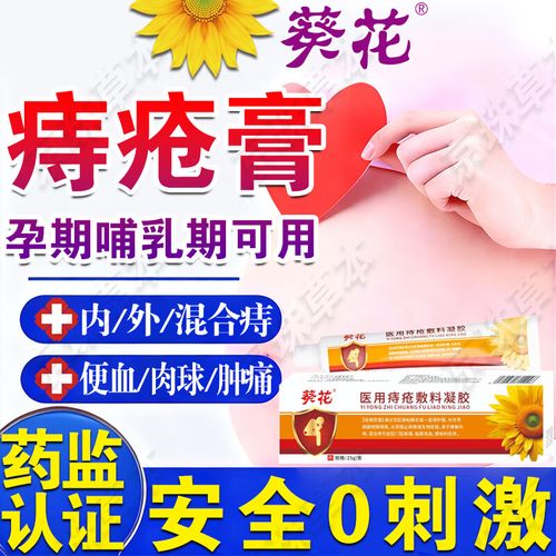 孕期痔疮用药安全优先，哪些药既有效又不会影响胎儿健康？-第2张图片-郑州医学网