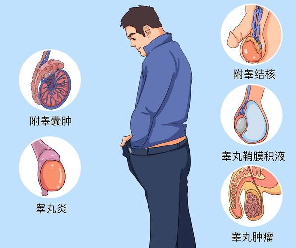儿童病毒性睾丸炎的病因、症状及家长该如何应对？-第2张图片-郑州医学网