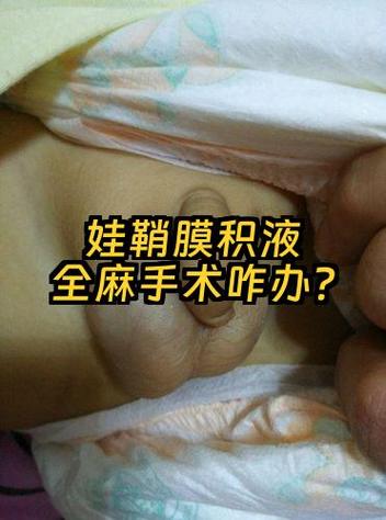 儿童病毒性睾丸炎的病因、症状及家长该如何应对？-第1张图片-郑州医学网