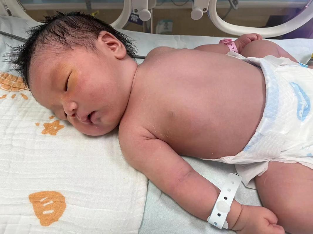 新生儿胆汁淤积的症状-第2张图片-郑州医学网 新生儿胆汁淤积的症状-第2张图片-郑州医学网