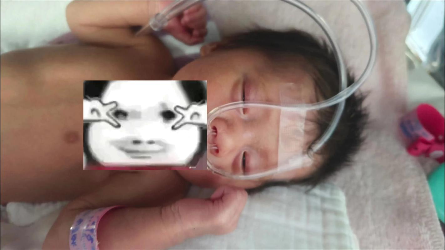 新生儿不睡觉总是吃奶-第2张图片-郑州医学网 新生儿不睡觉总是吃奶-第2张图片-郑州医学网