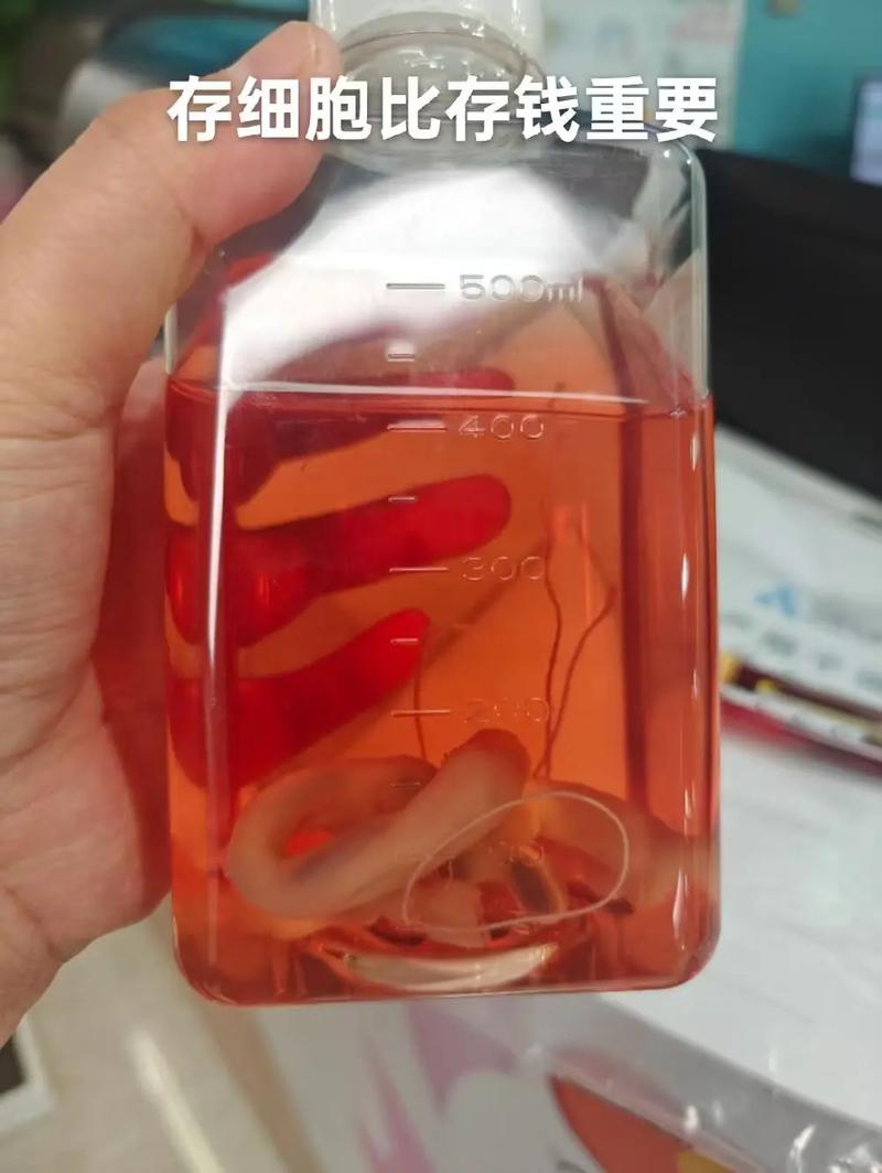 新生儿脐带干细胞存储-第1张图片-郑州医学网