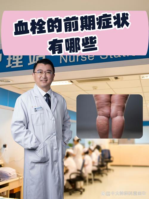 孕期血栓有什么症状吗-第2张图片-郑州医学网