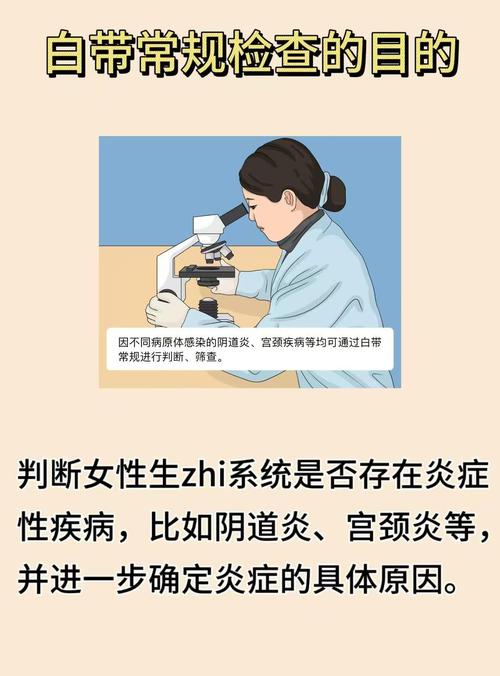 孕期白带异常该挂妇科还是产科？不同情况如何选择科室？-第2张图片-郑州医学网
