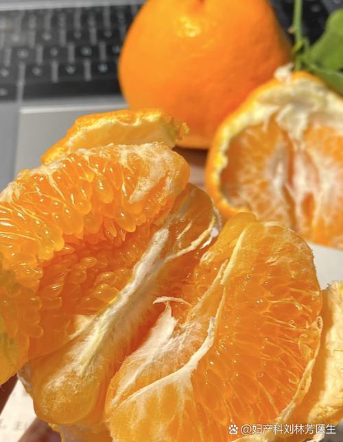 孕期便秘可以吃橘子吗-第2张图片-郑州医学网