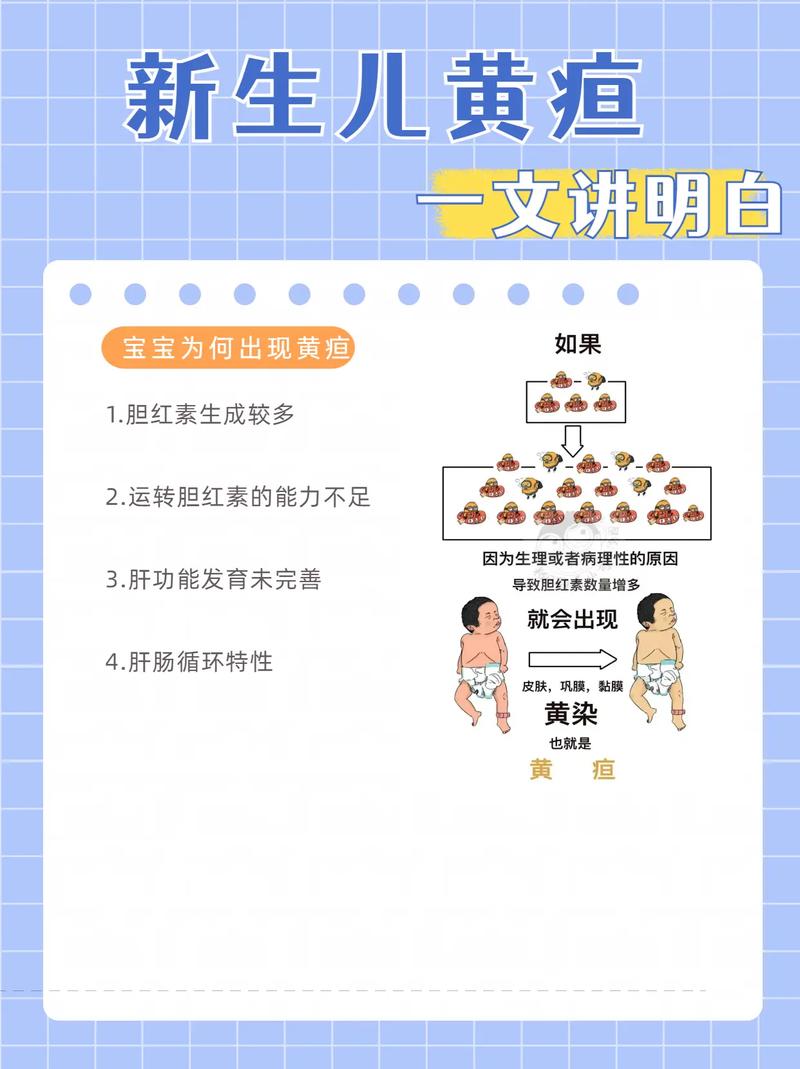 引起新生儿黄疸的原因-第2张图片-郑州医学网 引起新生儿黄疸的原因-第2张图片-郑州医学网