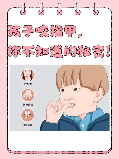 儿童老是咬指甲怎么办-第2张图片-郑州医学网