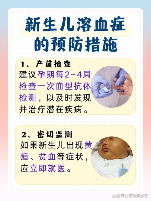 治疗新生儿溶血要多久-第1张图片-郑州医学网