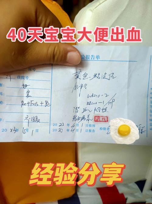 儿童便血不疼是什么病-第2张图片-郑州医学网