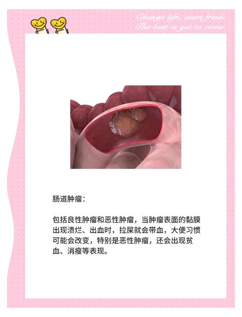 儿童便血不疼是什么病-第1张图片-郑州医学网