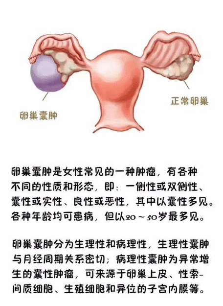 孕期黄体囊肿会自行消失吗？对胎儿有影响吗？需要治疗吗？-第2张图片-郑州医学网