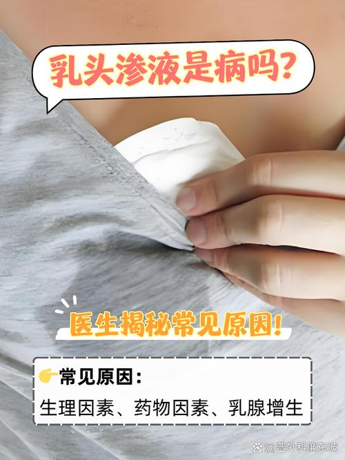 孕期乳房流水是正常生理现象还是异常信号？需警惕哪些潜在问题？-第2张图片-郑州医学网