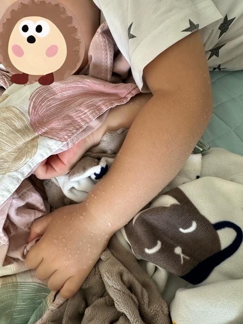 新生儿睡觉时总伸胳膊是正常现象还是身体不适的信号？-第1张图片-郑州医学网