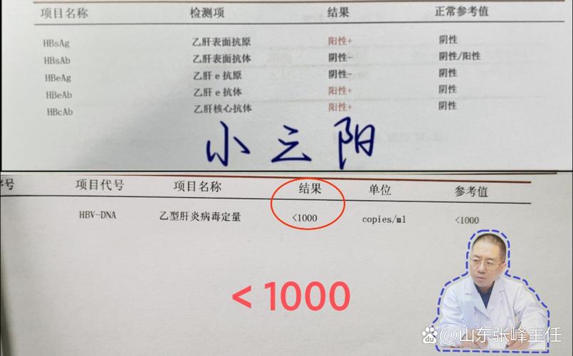 新生儿乙肝dna阴性-第2张图片-郑州医学网