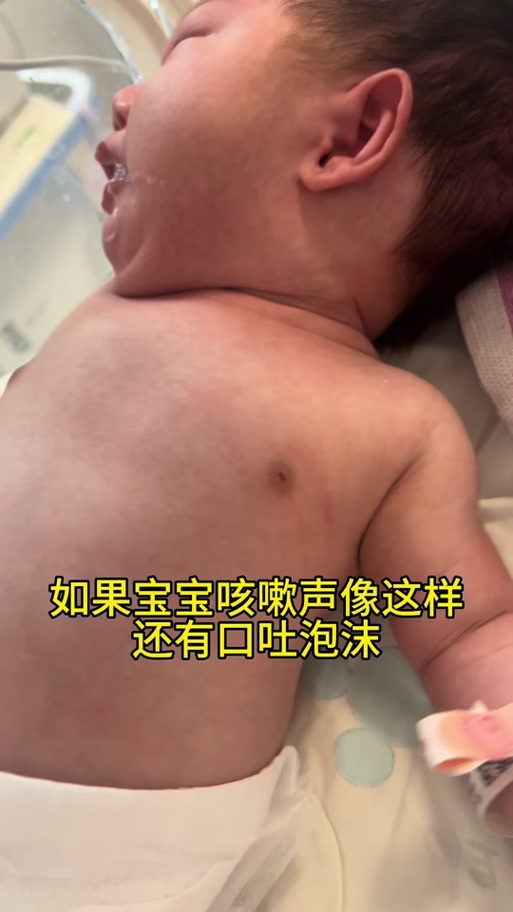 新生儿肺炎吐泡沫是正常现象吗?需要紧急就医吗?-第1张图片-郑州医学网 新生儿肺炎吐泡沫是正常现象吗?需要紧急就医吗?-第1张图片-郑州医学网