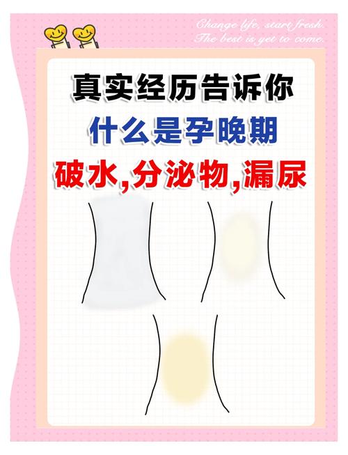 孕期小便失禁和羊水破怎么区分?这两种情况有什么本质区别?-第1张图片-郑州医学网 孕期小便失禁和羊水破怎么区分?这两种情况有什么本质区别?-第1张图片-郑州医学网