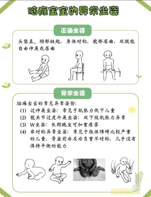 新生儿脑瘫早期信号有哪些？新手爸妈该如何科学判断？-第1张图片-郑州医学网