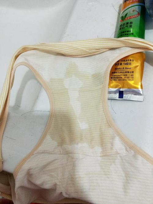 孕期阴部下面总是流水-第2张图片-郑州医学网 孕期阴部下面总是流水-第2张图片-郑州医学网